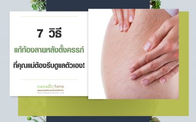 7 วิธีแก้ท้องลายหลังตั้งครรภ์ ที่คุณแม่ต้องรีบดูแลตัวเอง!